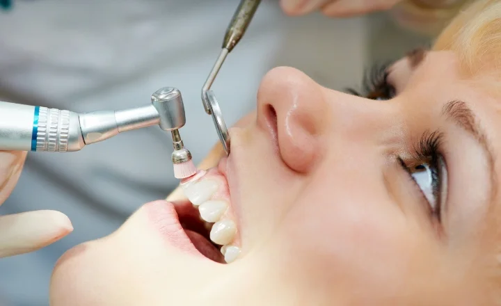 teeth scaling and polishing in Baner