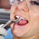 Tooth Extraction